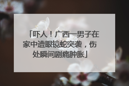 吓人！广西一男子在家中遭眼镜蛇突袭，伤处瞬间剧痛肿胀